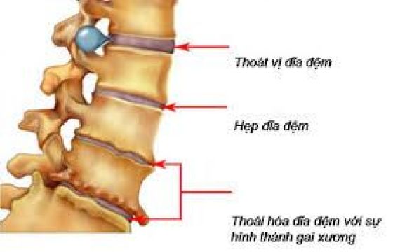 CẤU TẠO CỦA CỘT SỐNG